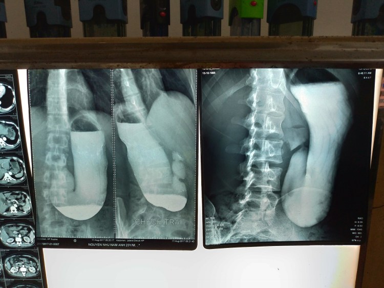 P_20181013_094819_vHDR_Auto_HP